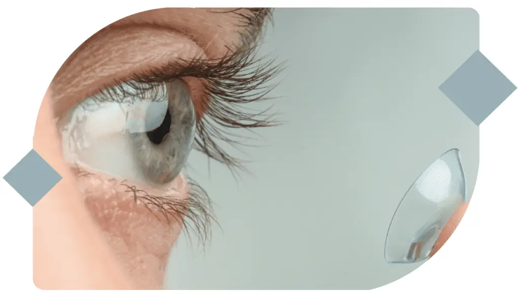 Lunettes - Design sans titre 10 - Optique Trousset